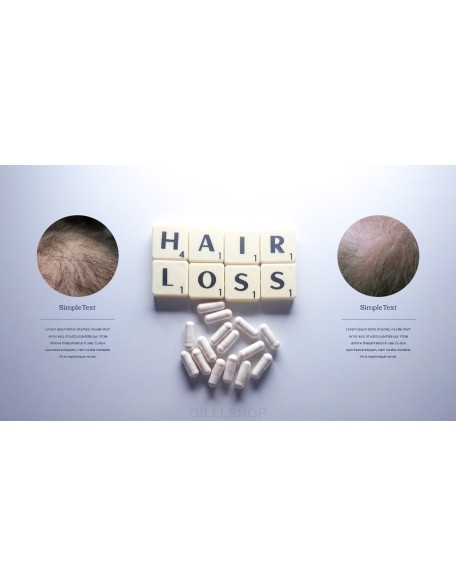 Hair Loss Treatments Business plan PPT Templates