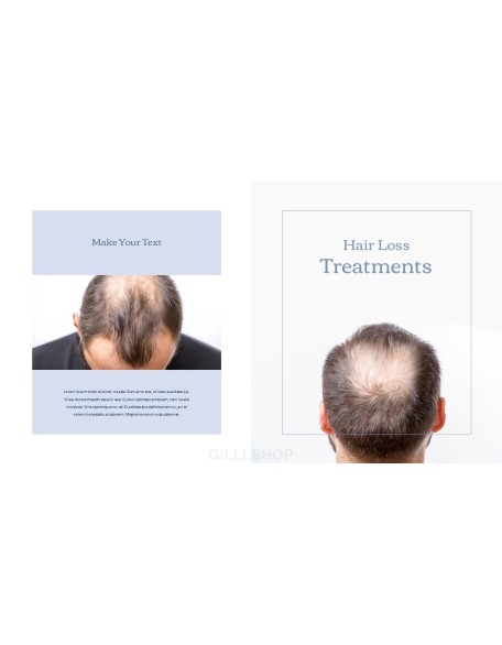 Hair Loss Treatments Business plan PPT Templates