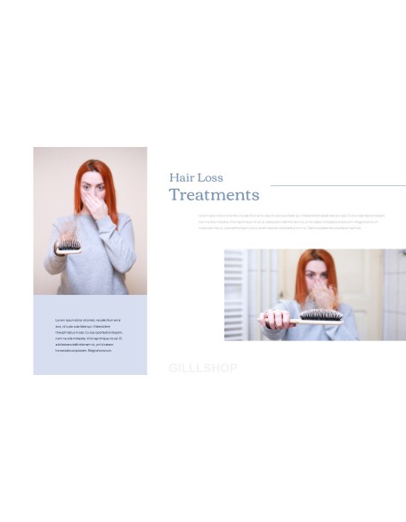 Hair Loss Treatments Business plan PPT Templates