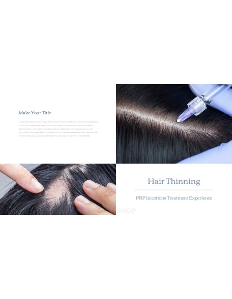 Hair Loss Treatments Business plan PPT Templates