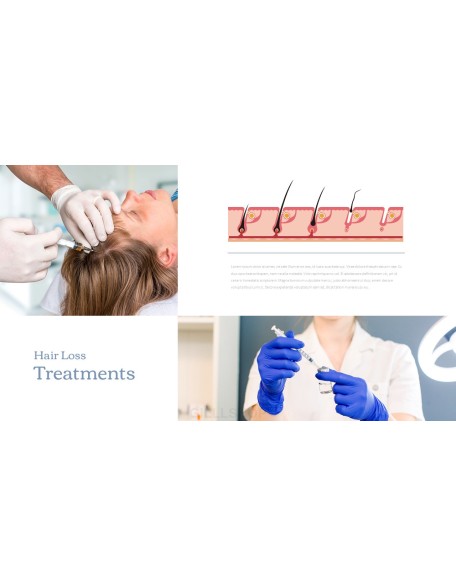 Hair Loss Treatments Business plan PPT Templates