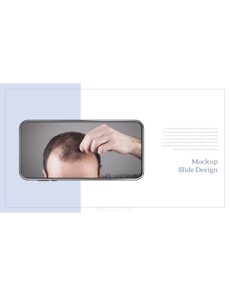 Hair Loss Treatments Business plan PPT Templates
