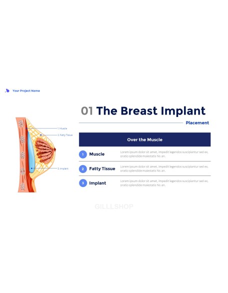 Plastic Surgery Presentation Templates