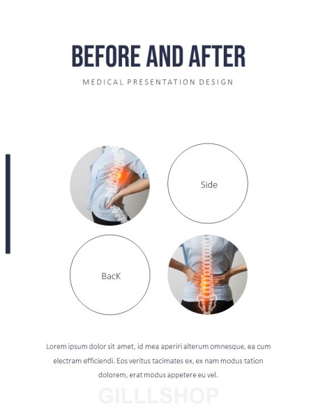 Orthopedics PowerPoint Theme