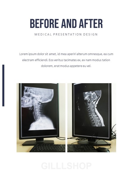 Orthopedics PowerPoint Theme