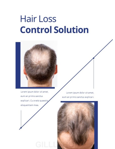 Hair Loss Control Clinic Slide PPT